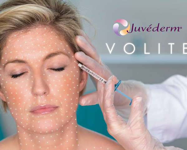 Juvederm Volite mélyhidratáló