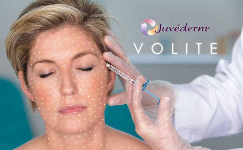 Juvederm Volite mélyhidratáló